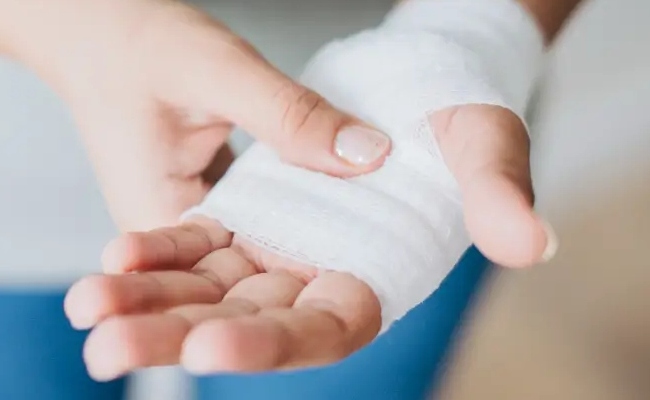 Auxilio acidente acumula com aposentadoria