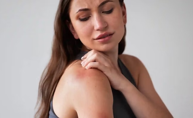 Lupus aposentadoria invalidez